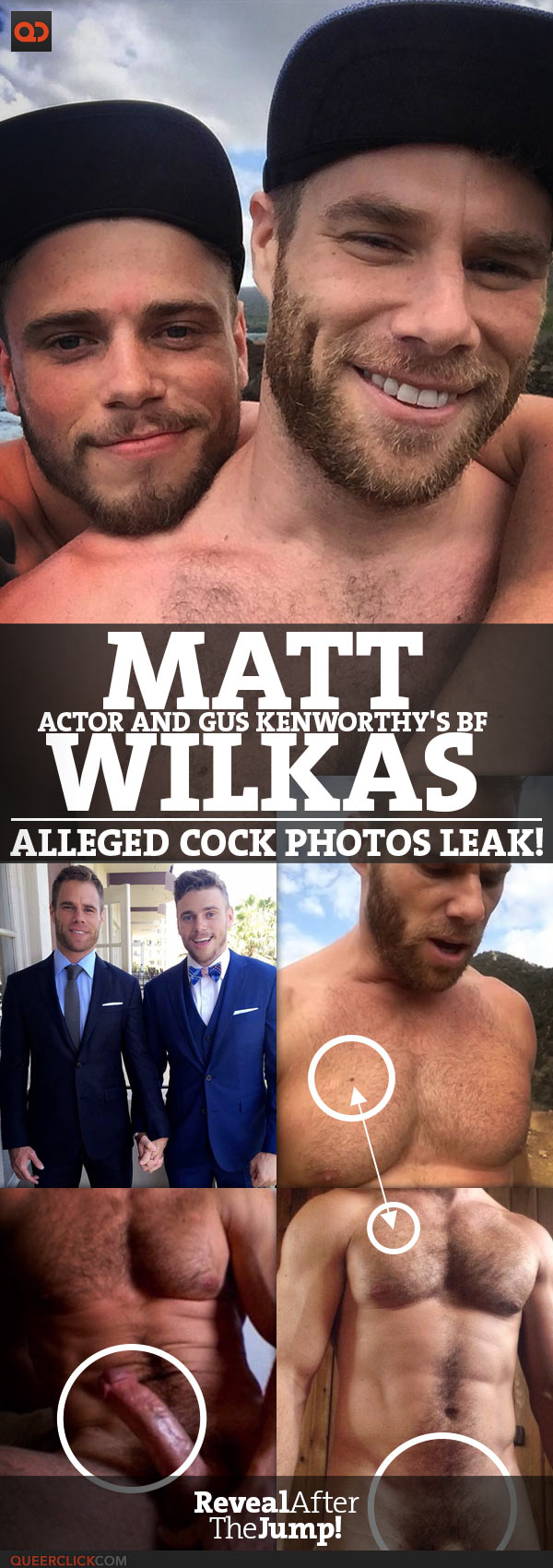 Matt Wilkas, Actor And Gus Kenworthy's BF, Alleged Cock Photos Leak!