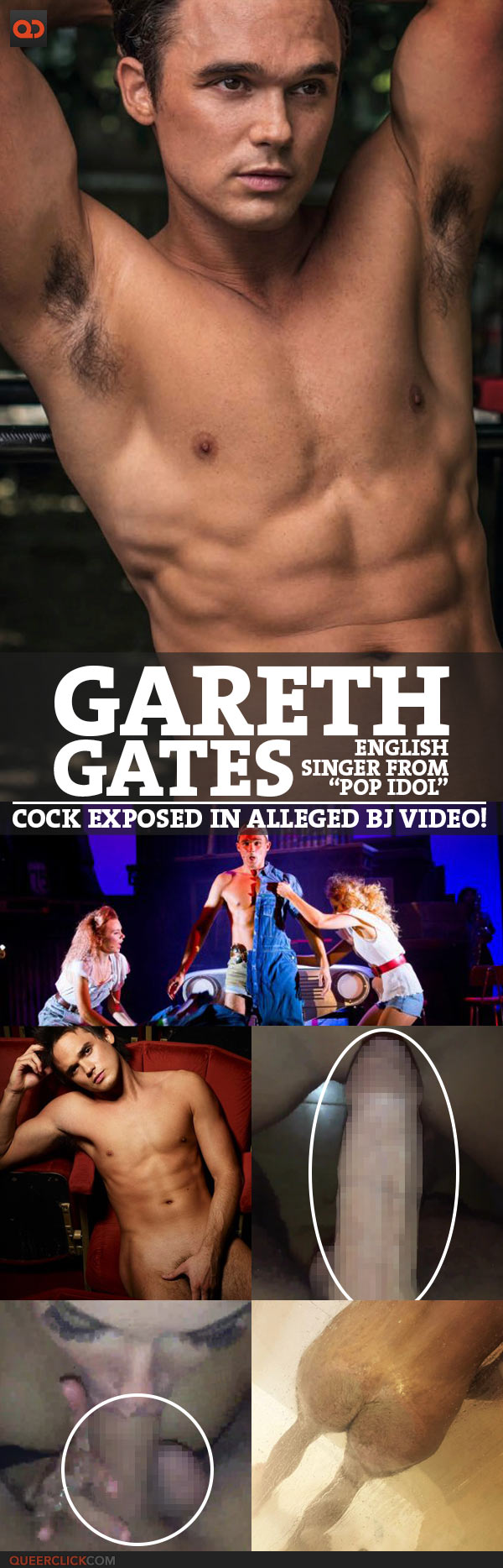 Gareth Gates, English Singer From “pop Idol”, Cock